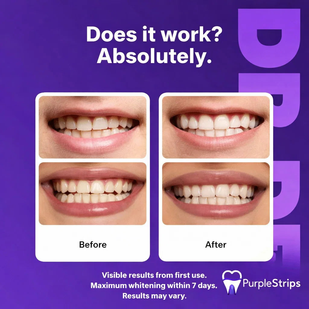 Purple Whitening Strips™